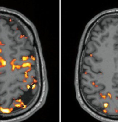 Poor sleep makes brain age faster: Study