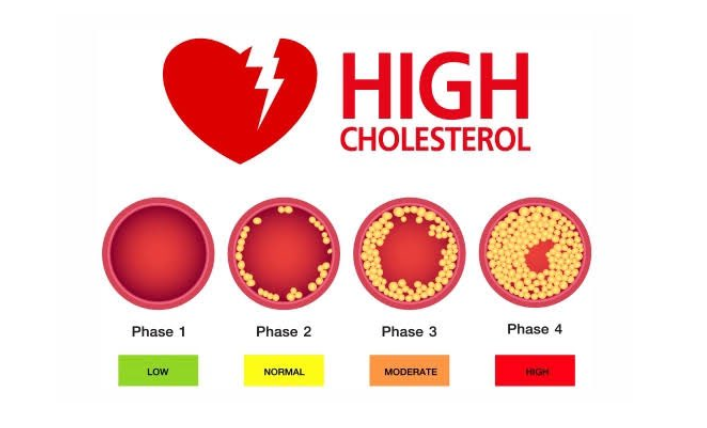 High cholesterol levels in blood